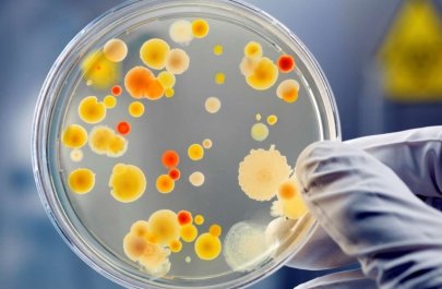 Ölümcül VİRUS sürətlə yayılır – Professordan XƏBƏRDARLIQ