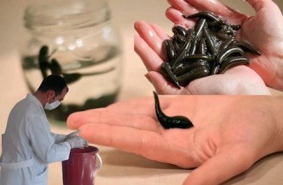 “Azərbaycanda zəli tükənir, ovlanmasına qadağa qoyulsun, bizdə 2 manat, xaricdə 20 avrodur” - FOTO+ÖZƏL