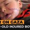 İsrail bombardmanından sonra 1 yaşlı uşağın üzünə 200 tikiş qoyuldu və əli kəsildi...-VİDEO